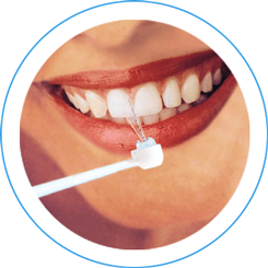 advantage sowash oral irrigator